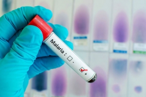 Lutte contre le Paludisme :En Afrique, plus de 200 millions de cas de paludisme chaque ann&eacute;e (&hellip;) et plus de 400 000 d&eacute;c&egrave;s&raquo;