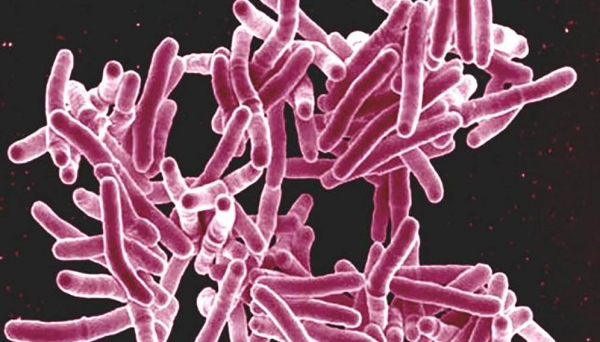 Les cas de tuberculose baissent trop lentement pour atteindre les objectifs fix&eacute;s pour 2020