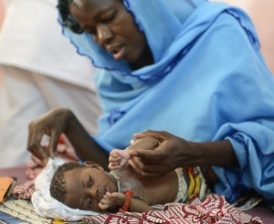 Niger/Nigeria : crise de malnutrition infantile