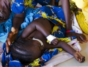 Malnutrition: 8 millions d&rsquo;enfants menac&eacute;s (ONU)