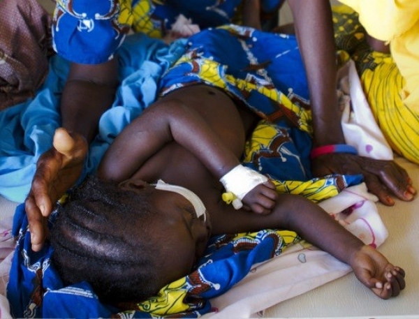 Malnutrition: 8 millions d&rsquo;enfants menac&eacute;s (ONU)