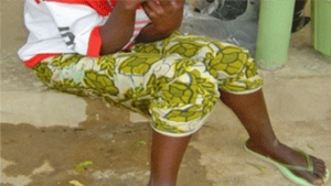 L&rsquo;UNFPA veut &eacute;radiquer d&rsquo;ici 2030 la fistule en Afrique de l&rsquo;ouest et du centre