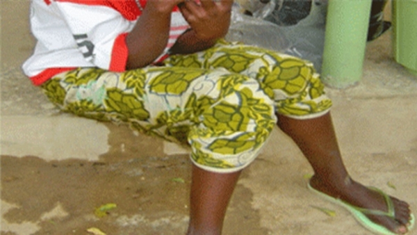 L&rsquo;UNFPA veut &eacute;radiquer d&rsquo;ici 2030 la fistule en Afrique de l&rsquo;ouest et du centre