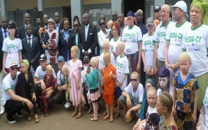 C&ocirc;te d&rsquo;Ivoire-Sant&eacute; : des consultations ophtalmologiques gratuites pour 150 albinos &agrave; Korhogo