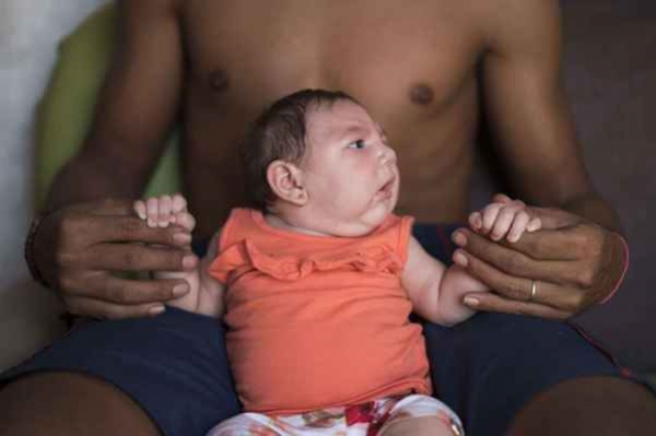 Zika : ce virus qui transforme les b&eacute;b&eacute;s. Quels en sont les sympt&ocirc;mes et les risques ?